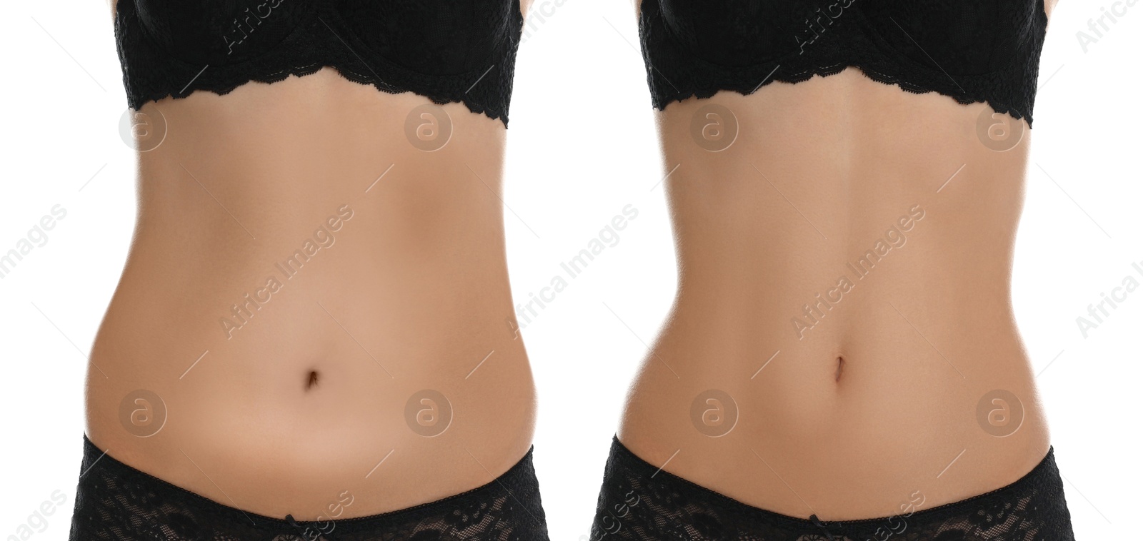 Image of Woman showing her belly with excess fat on one side and slim on other, closeup. Collage with photos before and after weight loss on white background