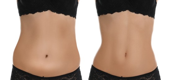 Woman showing her belly with excess fat on one side and slim on other, closeup. Collage with photos before and after weight loss on white background