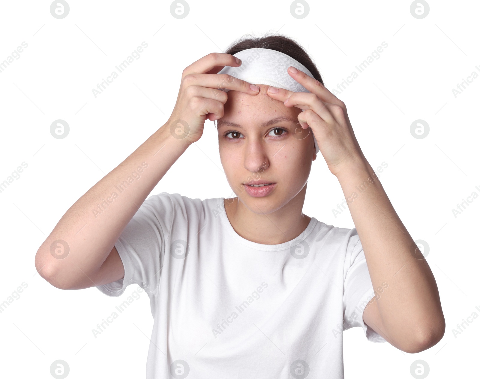 Photo of Teenage girl popping pimple on her face against white background. Acne problem