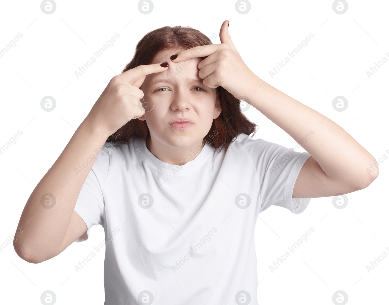 Photo of Teenage girl popping pimple on her face against white background. Acne problem