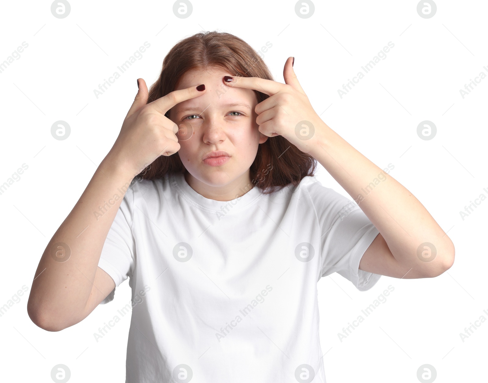 Photo of Teenage girl popping pimple on her face against white background. Acne problem