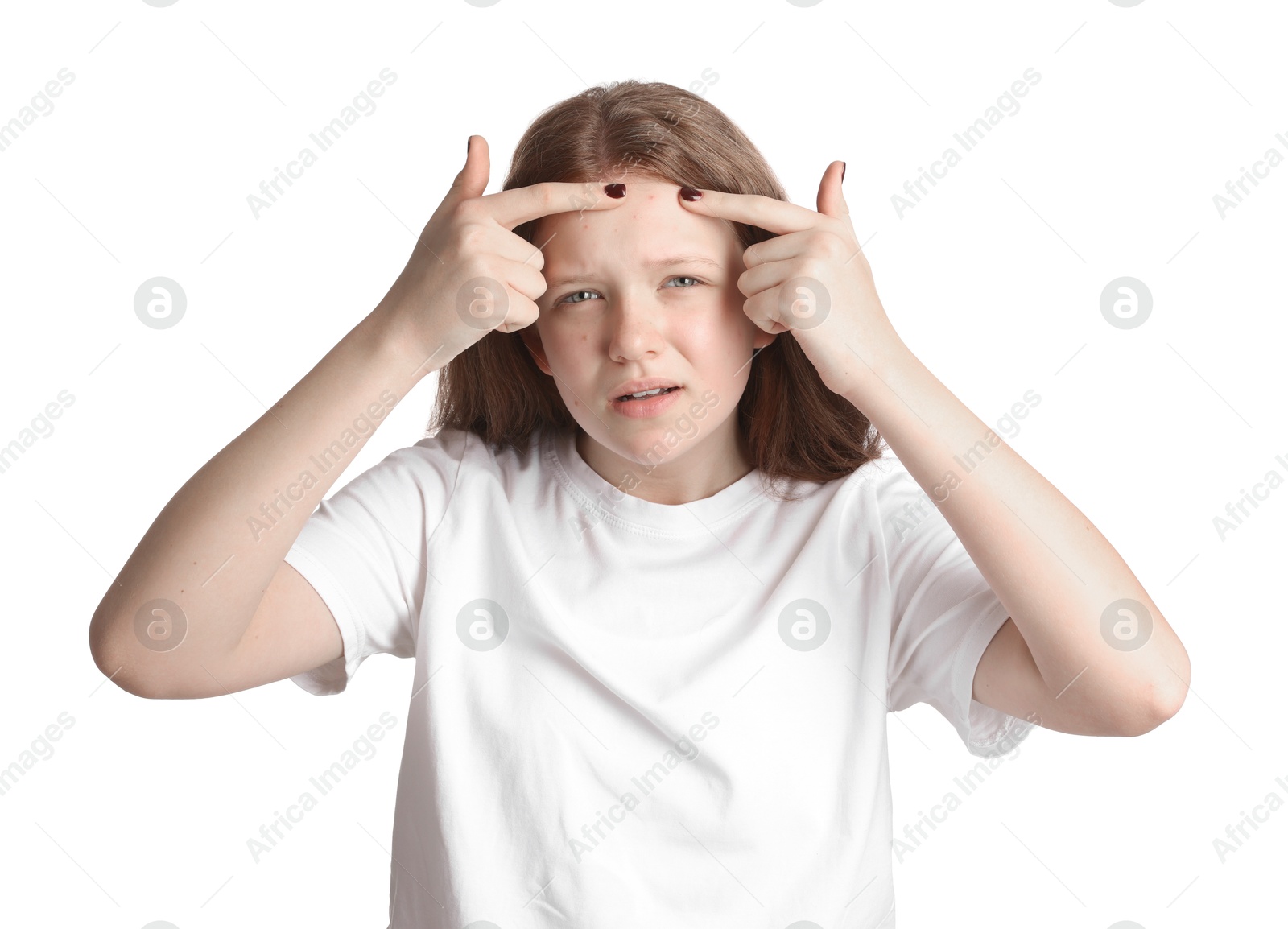 Photo of Teenage girl popping pimple on her face against white background. Acne problem