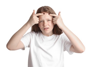 Teenage girl popping pimple on her face against white background. Acne problem