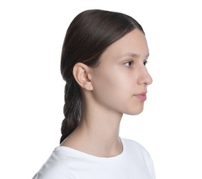 Photo of Teenage girl with acne problem on white background