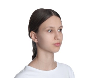 Photo of Teenage girl with acne problem on white background