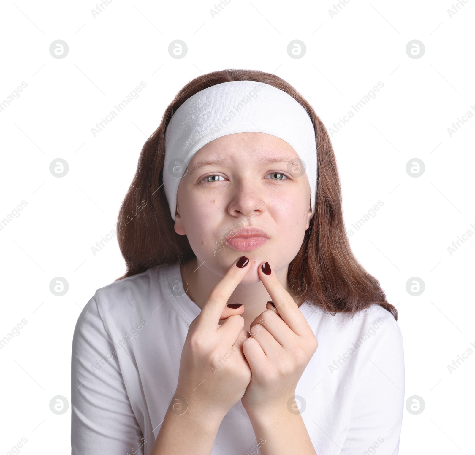 Photo of Teenage girl popping pimple on her face against white background. Acne problem