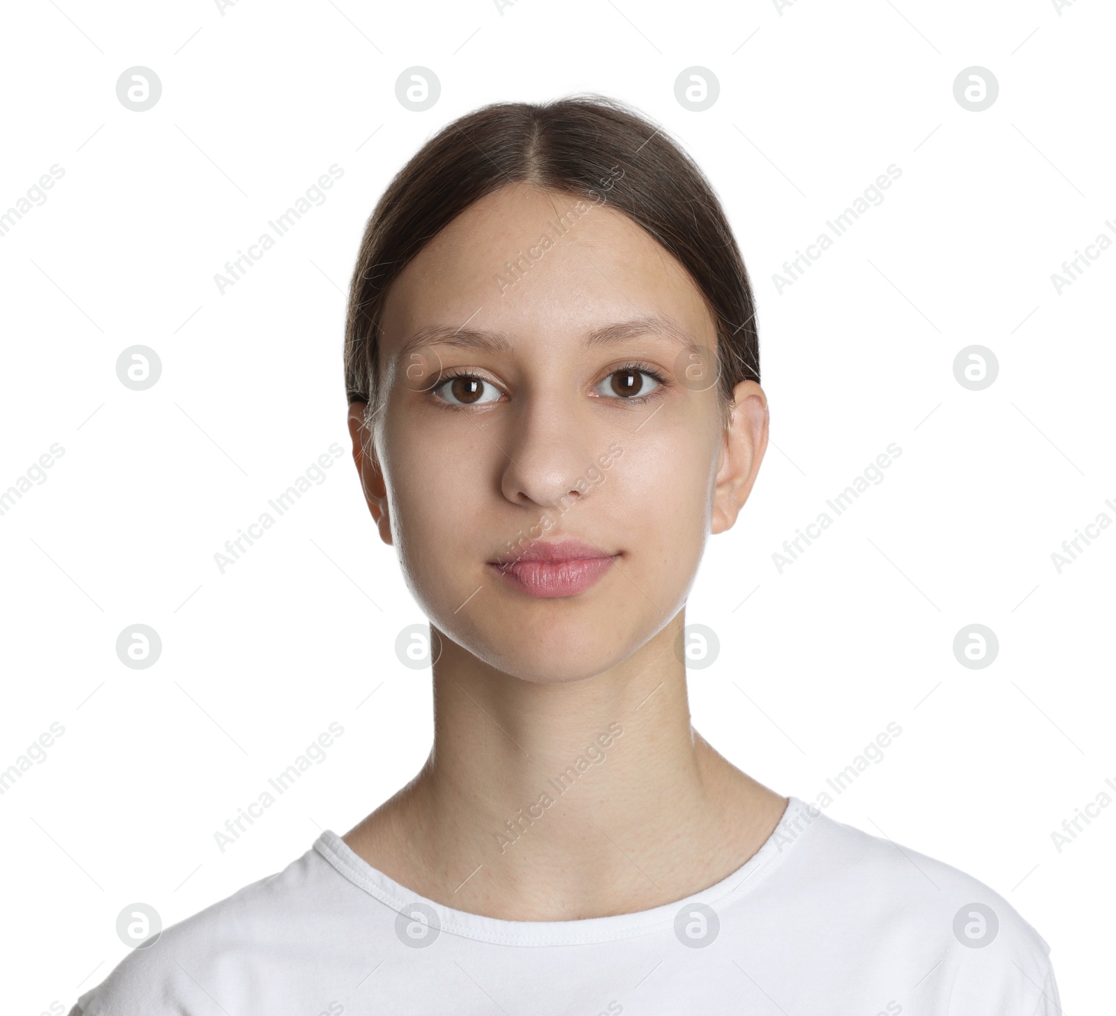 Photo of Teenage girl with acne problem on white background