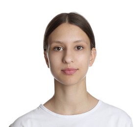 Photo of Teenage girl with acne problem on white background