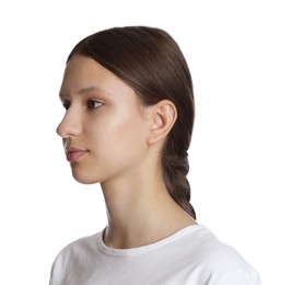 Photo of Teenage girl with acne problem on white background