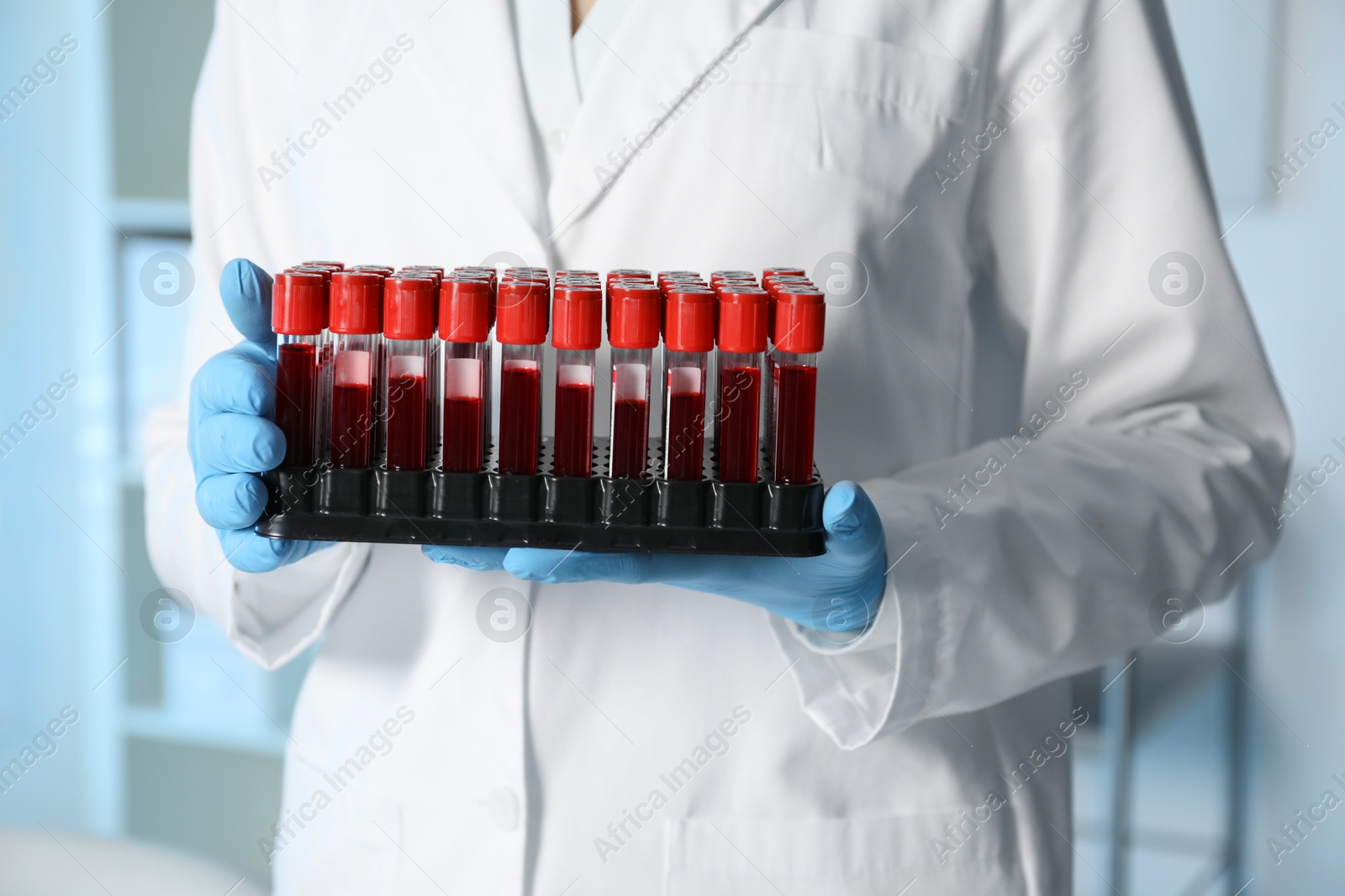 Photo of Laboratory testing. Doctor with blood samples indoors, closeup