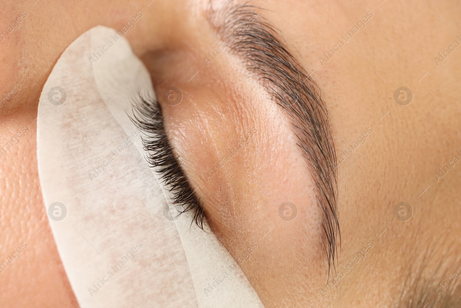 Photo of Woman with under eye patch, closeup view