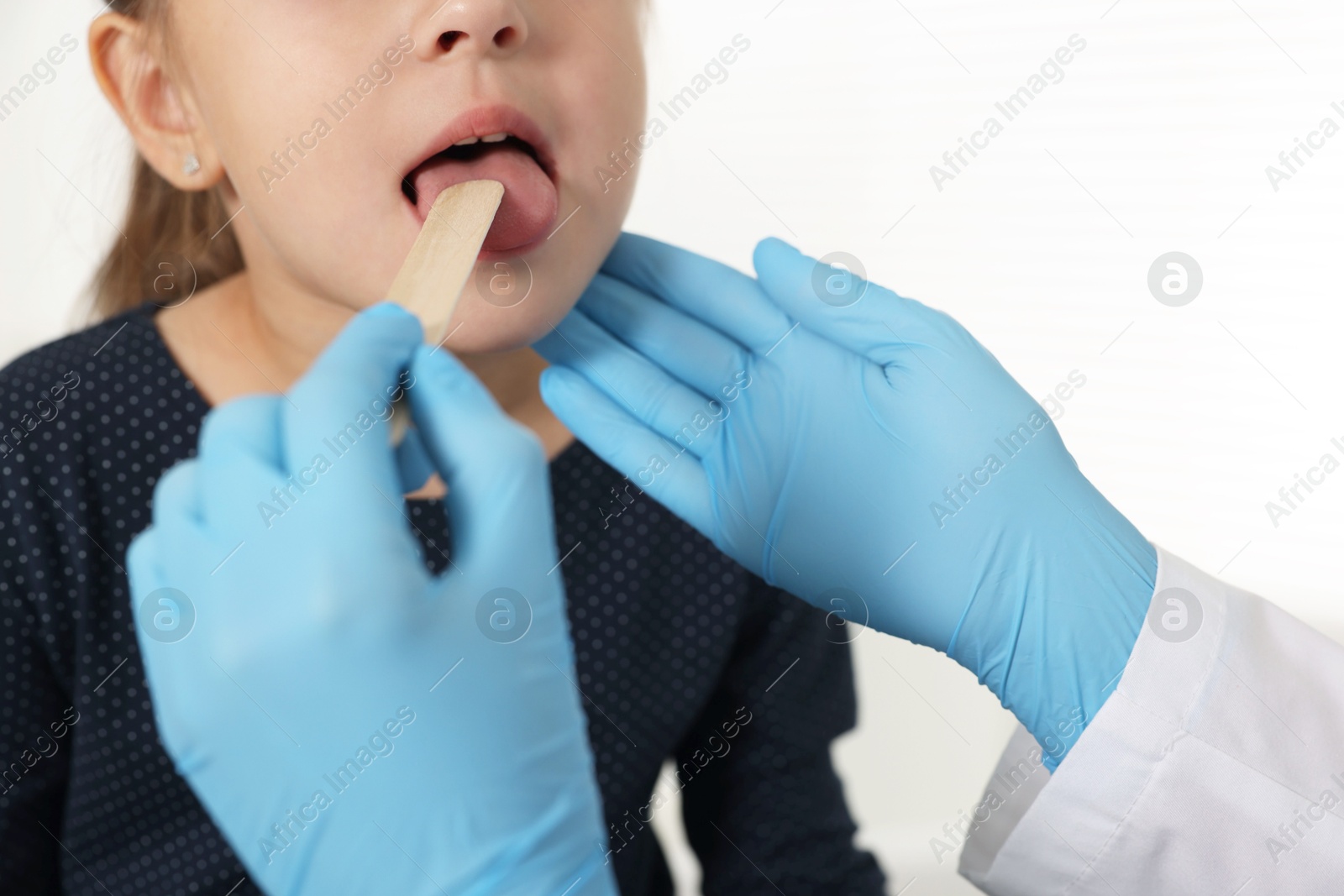 Photo of Doctor examining girl's throat with tongue depressor in clinic, closeup