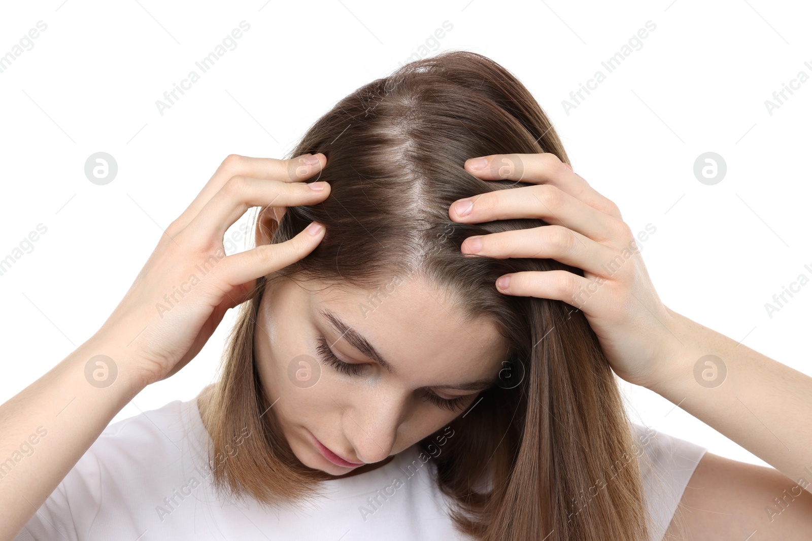 Photo of Girl with hair loss problem on white background