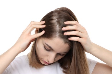 Photo of Girl with hair loss problem on white background