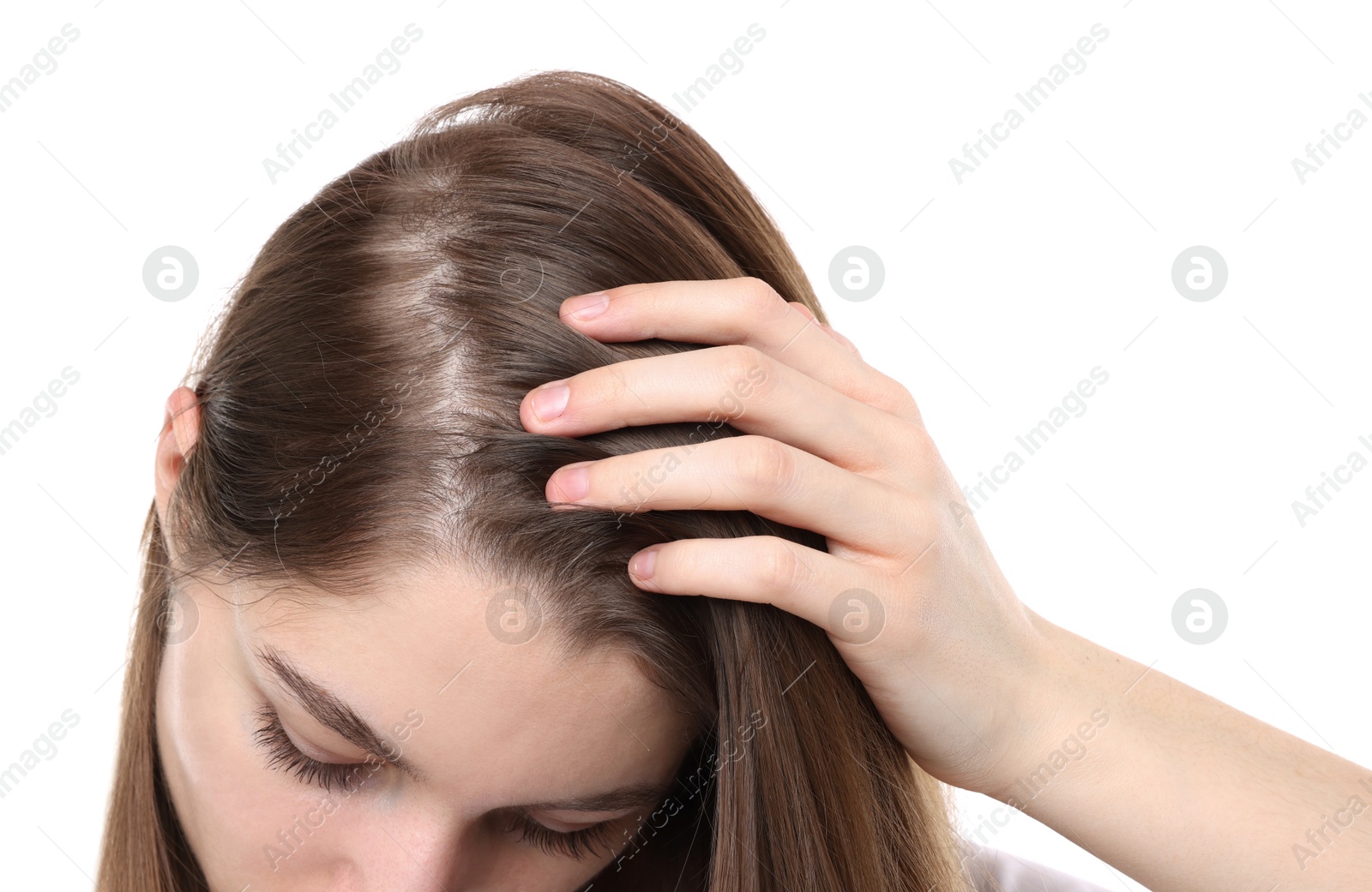 Photo of Girl with hair loss problem on white background, closeup