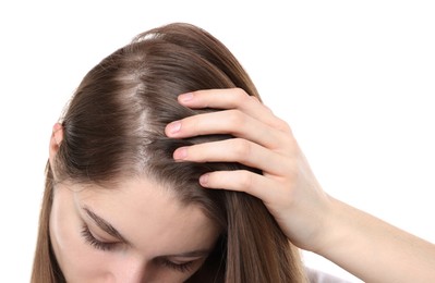 Girl with hair loss problem on white background, closeup