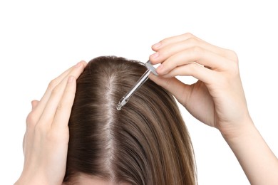 Photo of Hair loss problem. Girl applying serum onto hairline on white background, closeup