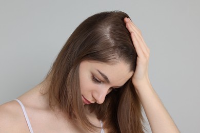 Photo of Girl with hair loss problem on grey background