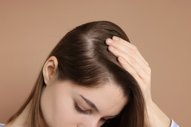 Photo of Girl with hair loss problem on dark beige background, closeup