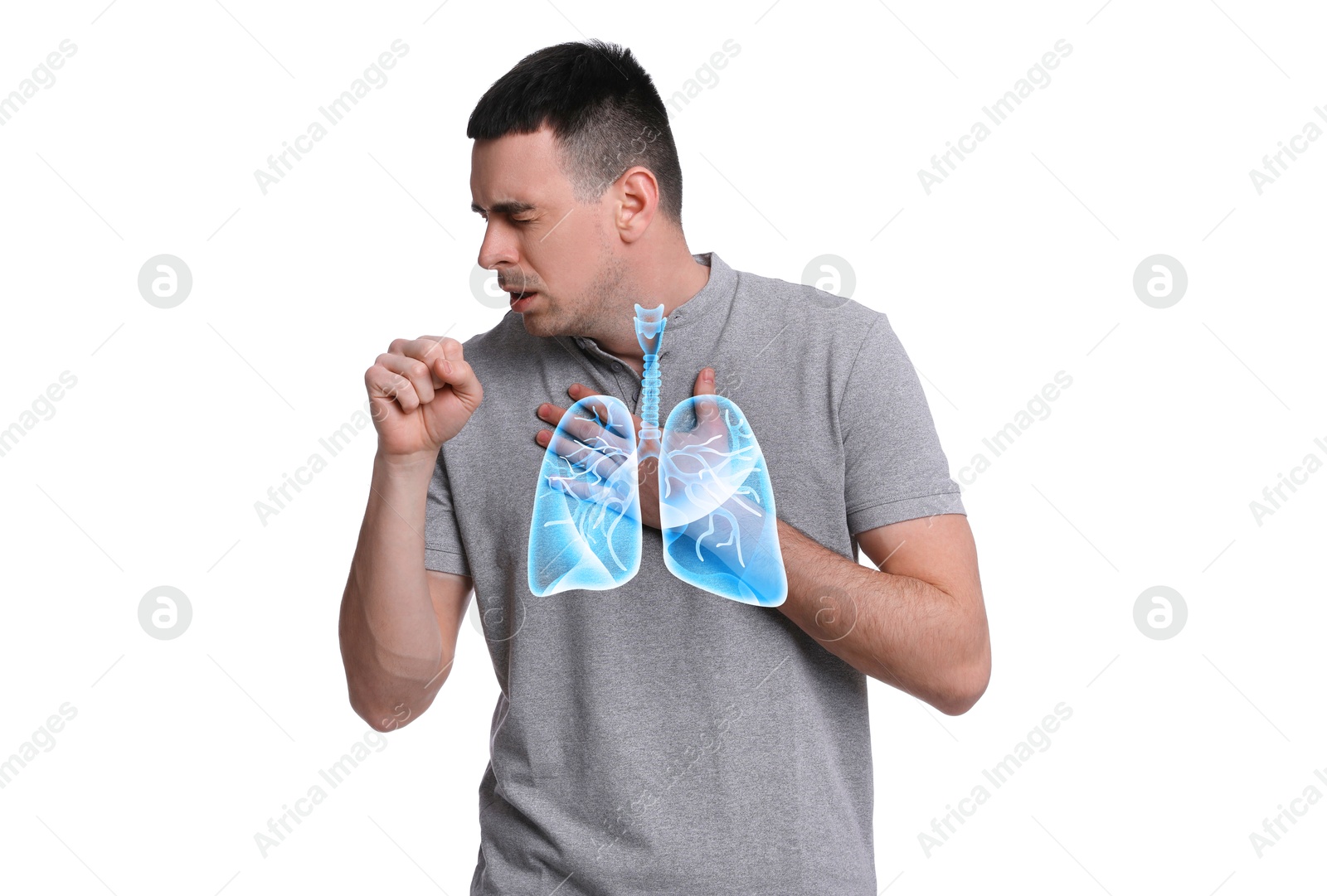 Image of Man with asthma coughing on white background. Illustration of lungs