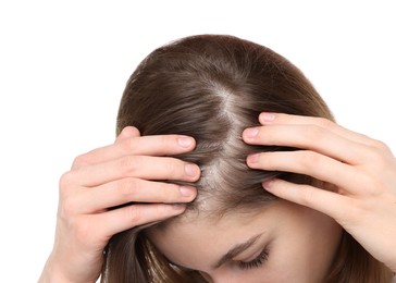 Photo of Girl with hair loss problem on white background, closeup