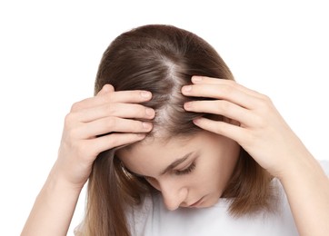 Photo of Girl with hair loss problem on white background