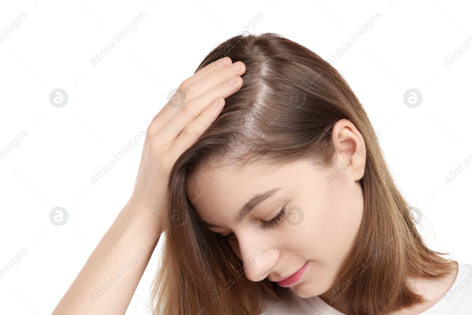 Photo of Girl with hair loss problem on white background