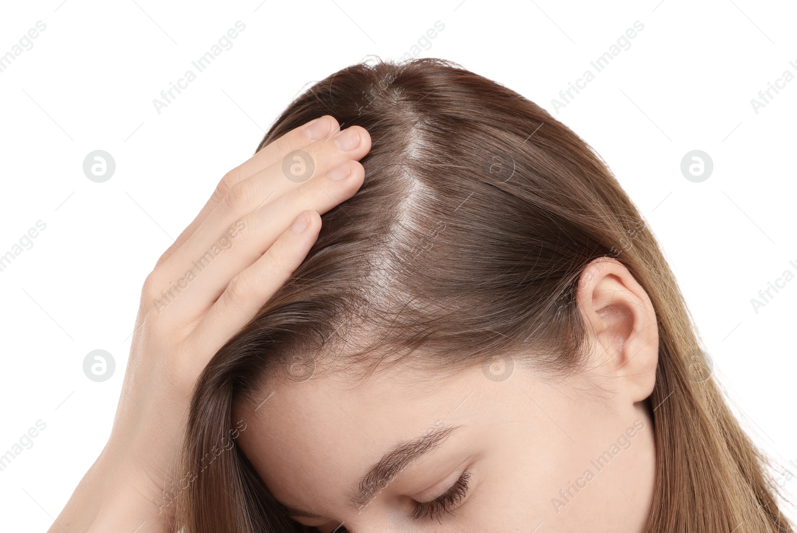 Photo of Girl with hair loss problem on white background, closeup