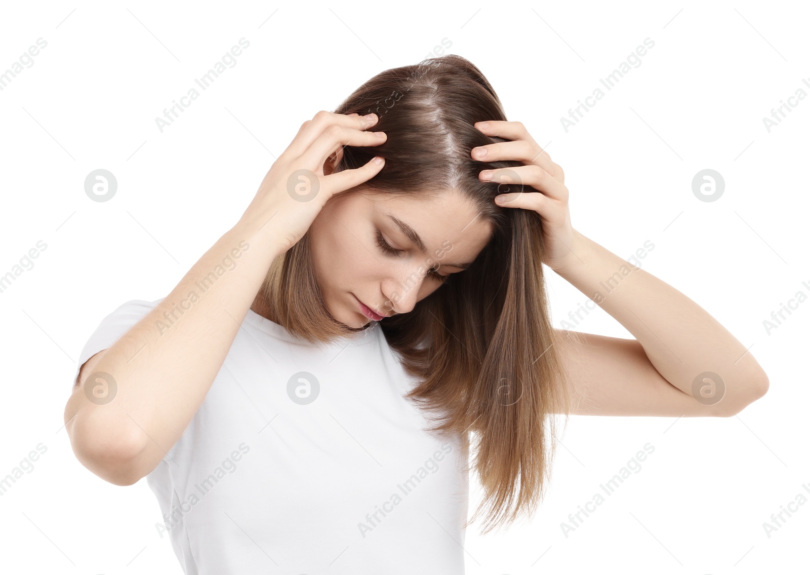 Photo of Girl with hair loss problem on white background