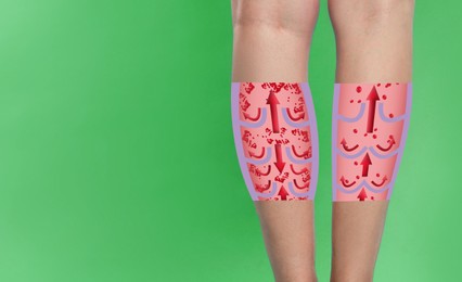 Image of Varicose veins. Woman showing legs on green background, closeup. Illustrations of damaged and healthy vein, longitudinal section