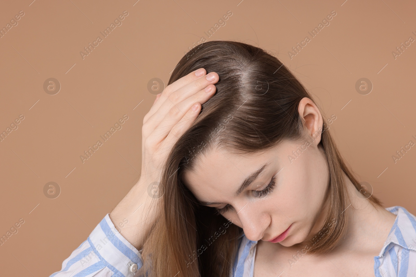 Photo of Girl with hair loss problem on dark beige background