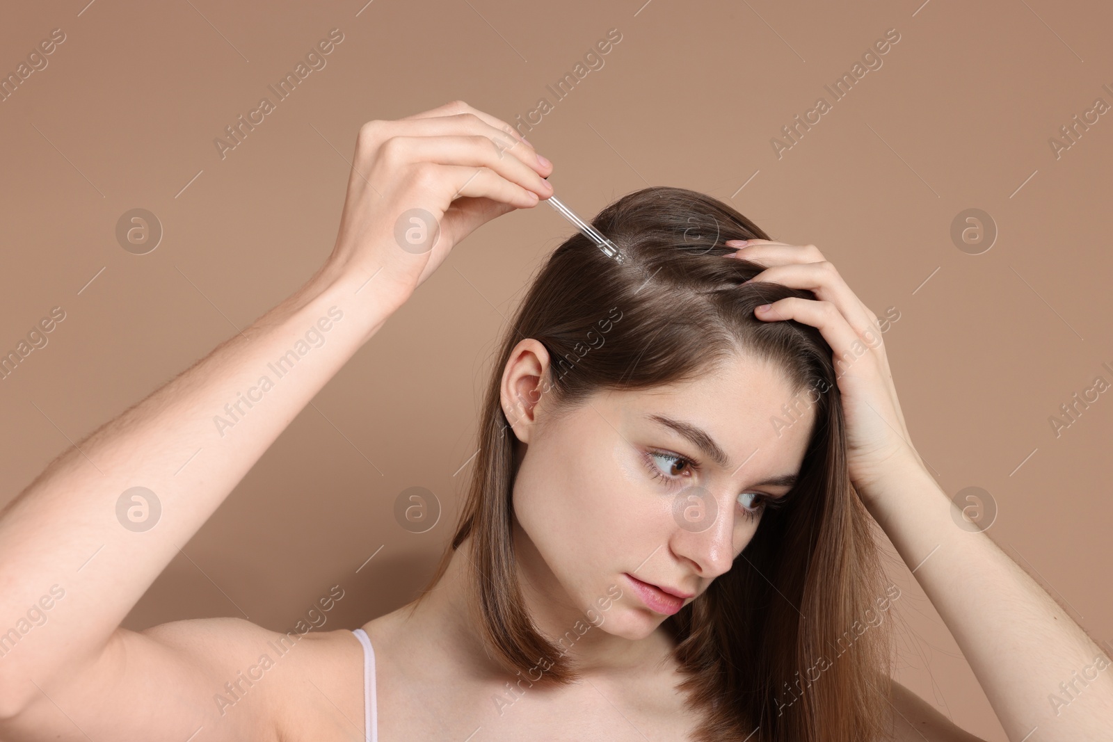 Photo of Hair loss problem. Girl applying serum onto hairline on dark beige background