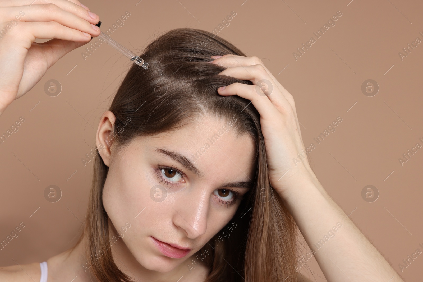 Photo of Hair loss problem. Girl applying serum onto hairline on dark beige background