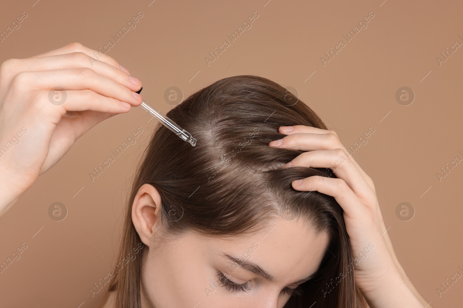 Photo of Hair loss problem. Girl applying serum onto hairline on dark beige background, closeup