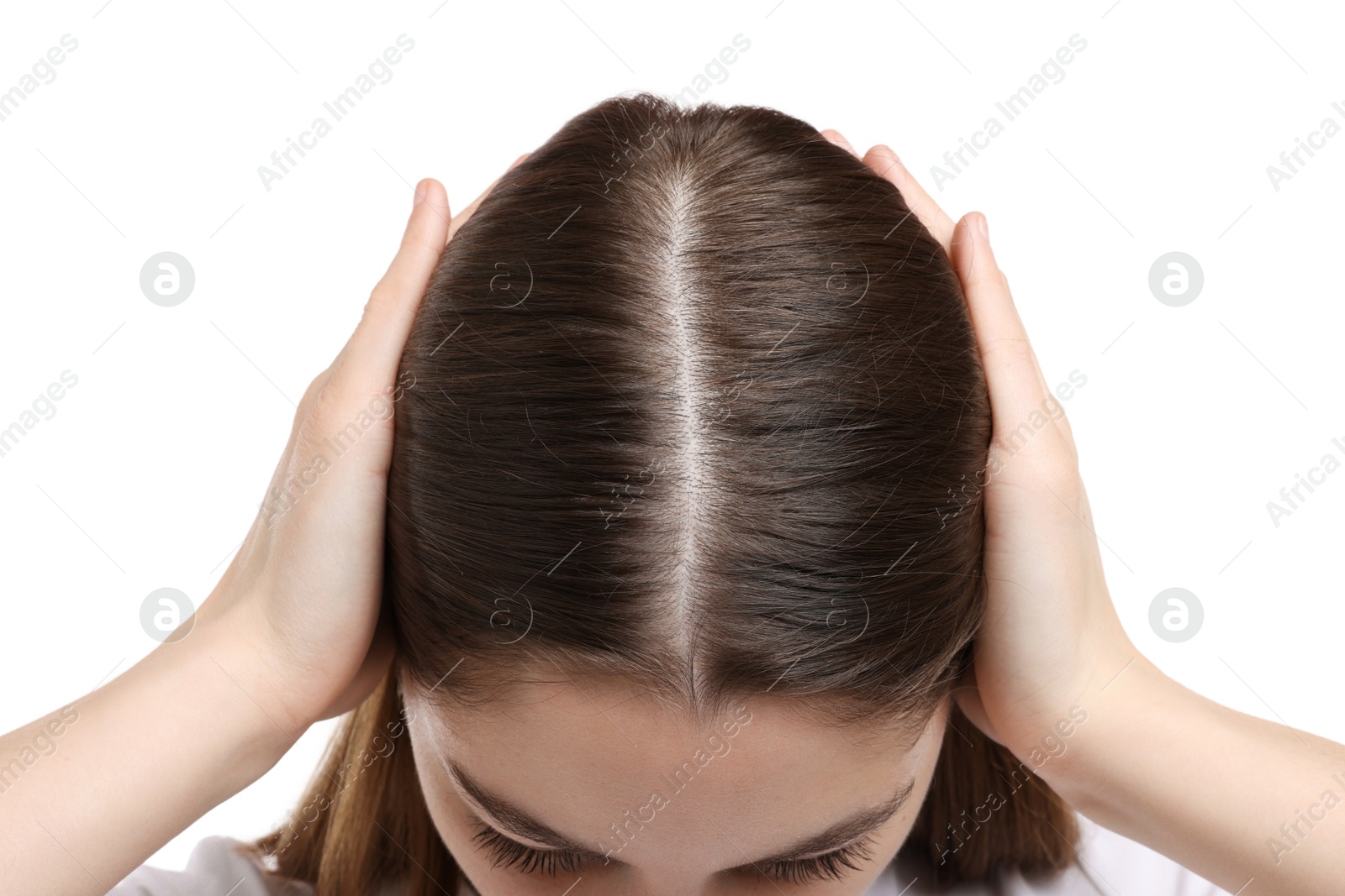 Photo of Girl with hair loss problem on white background, closeup