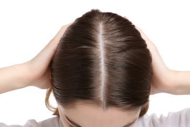 Photo of Girl with hair loss problem on white background, closeup