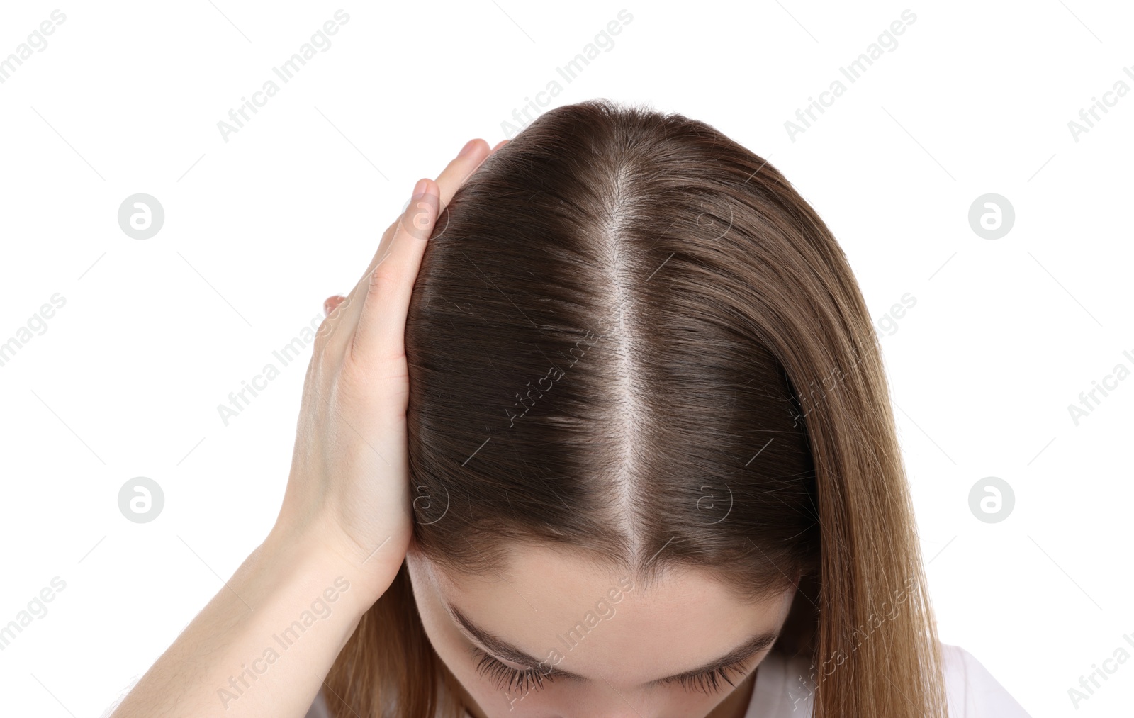 Photo of Girl with hair loss problem on white background, closeup