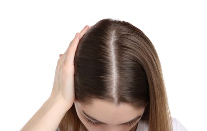 Photo of Girl with hair loss problem on white background, closeup