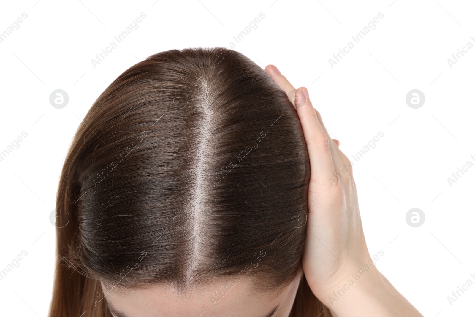 Photo of Girl with hair loss problem on white background, closeup