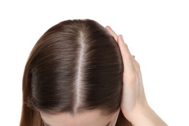 Photo of Girl with hair loss problem on white background, closeup