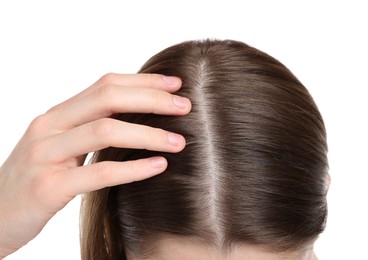 Photo of Girl with hair loss problem on white background, closeup