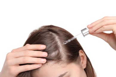 Photo of Hair loss problem. Girl applying serum onto hairline on white background, closeup