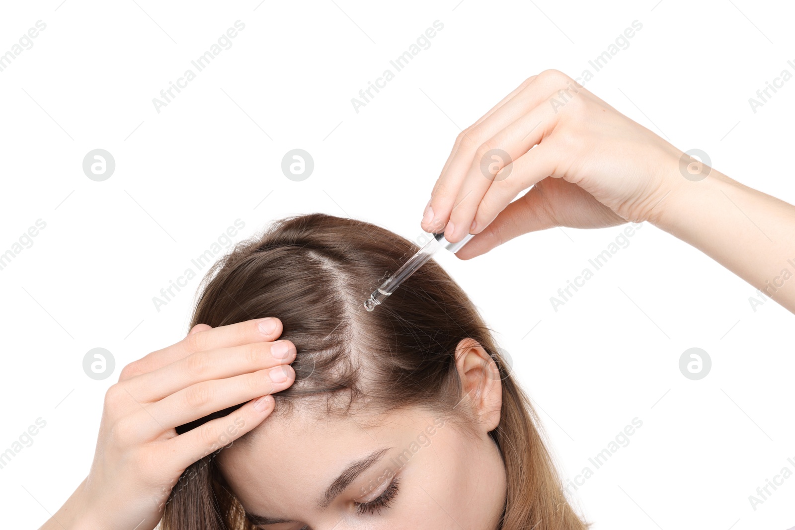 Photo of Hair loss problem. Girl applying serum onto hairline on white background, closeup