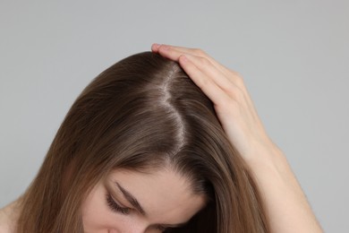 Photo of Girl with hair loss problem on grey background