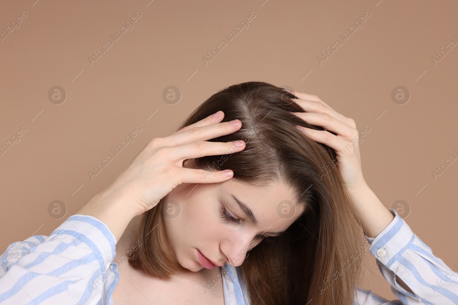 Photo of Girl with hair loss problem on dark beige background