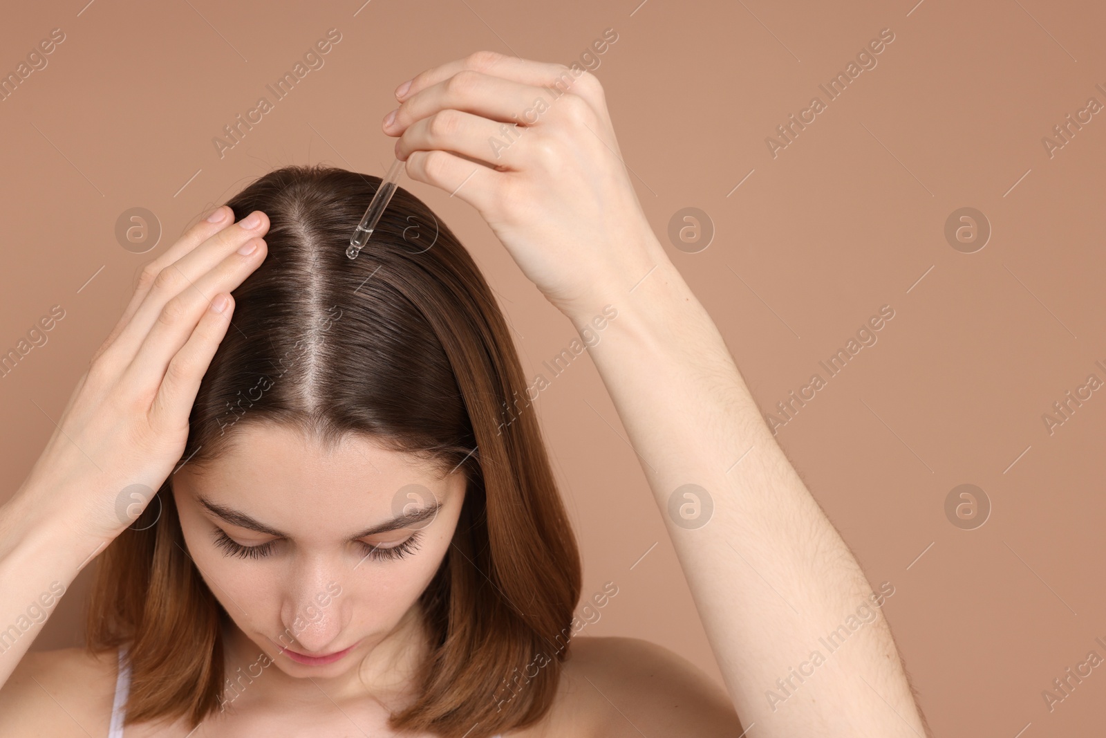 Photo of Hair loss problem. Girl applying serum onto hairline on beige background, closeup