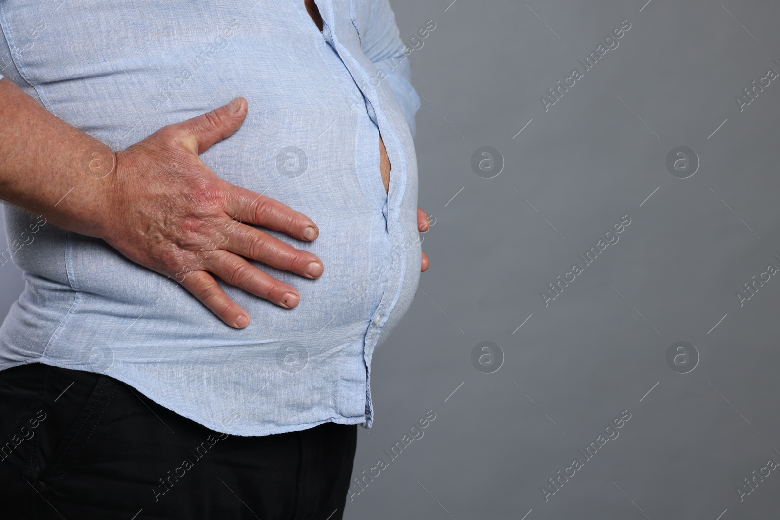 Photo of Overweight man in tight shirt on grey background, closeup. Space for text