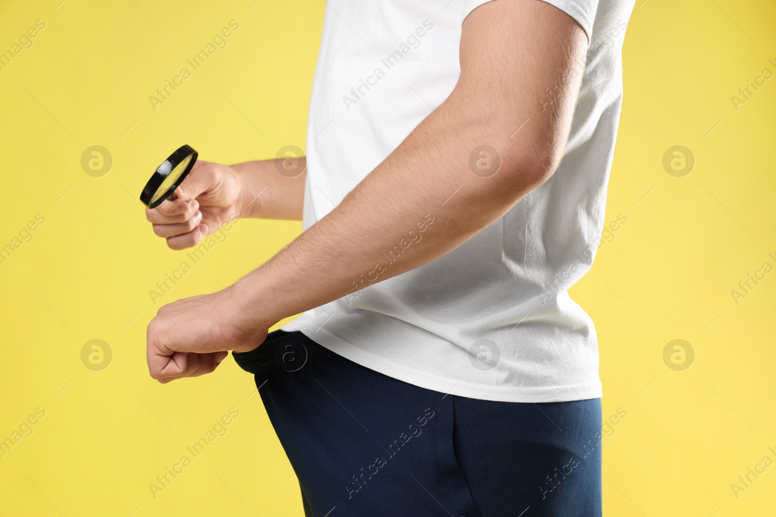 Photo of STD (sexually transmitted diseases). Man examining intimate area with magnifying glass on yellow background, closeup