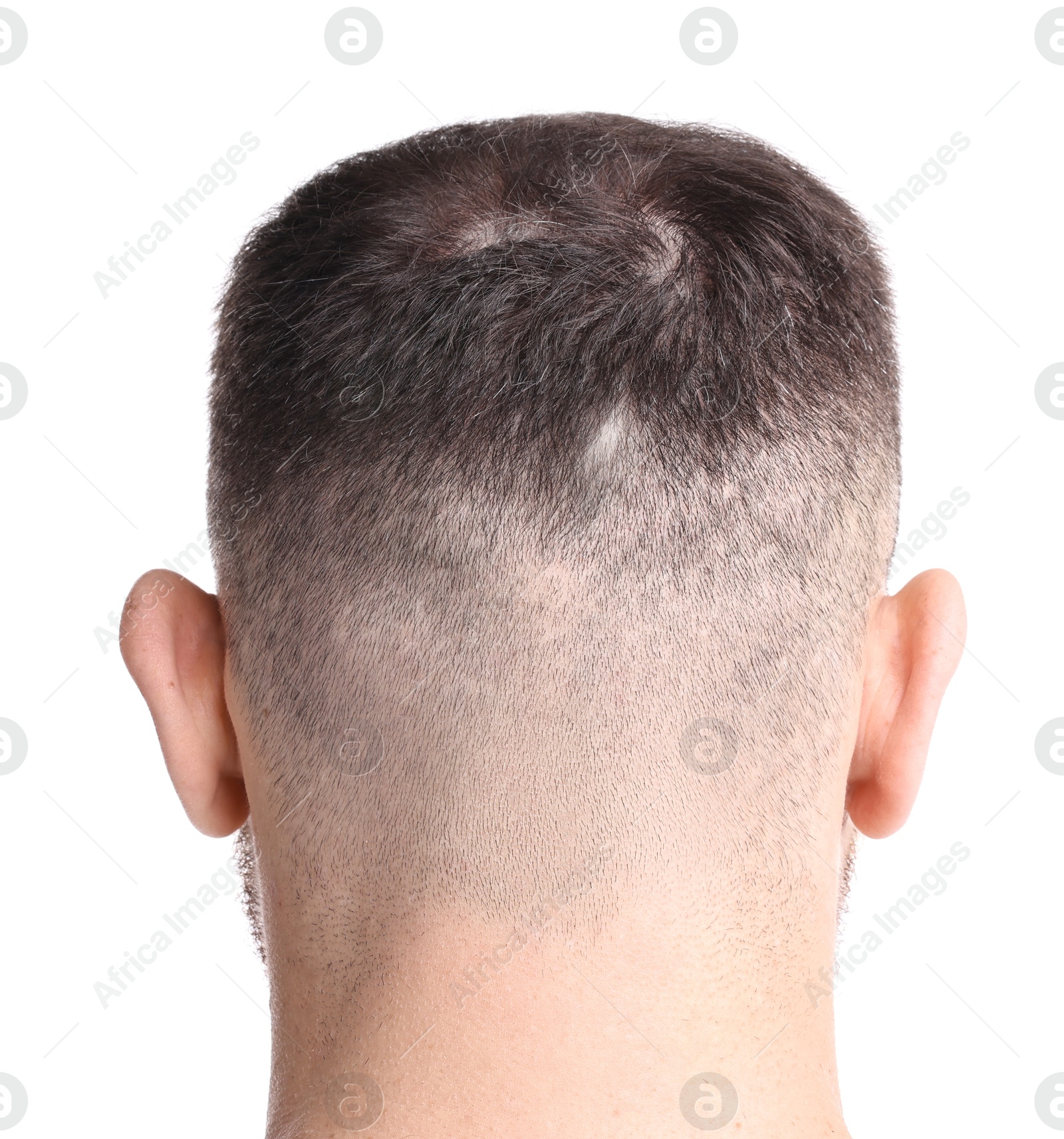 Photo of Man suffering from baldness on white background, back view