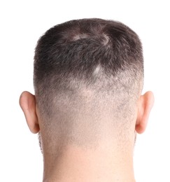 Photo of Man suffering from baldness on white background, back view